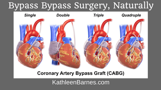 bypass surgery