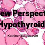 hypothyroidism