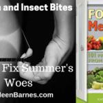 Sunburn and Insect Bites